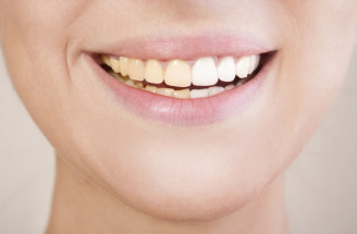 Ako predísť zafarbeniu zubov? Poradíme pri akom jedle by ste si mali dať pozor