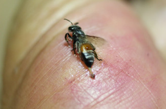 Prvá pomoc pri uštipnutí včelou, osou, sršňom: Osvedčená cibuľa už je pasé!