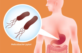 Helikobakter pylori: Spozoruj prvotné príznaky ochorenia čo najskôr!