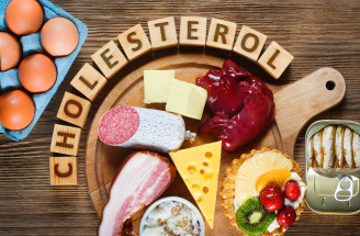 Čo sú fakty a čo nie? Toto sú najväčšie mýty o cholesterole!