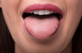 Nauč sa diagnostikovať choroby podľa stavu jazyka! Ktoré príznaky neignorovať?
