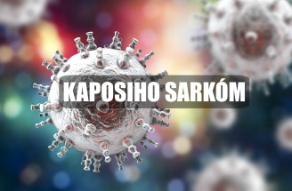 Zriedkavé nádorové ochorenie: Čo spôsobuje Kaposiho sarkóm?