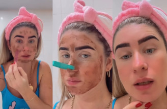 Brazílska influencerka a jej netradičná starostlivosť o pleť – neuveríš, čo si natrela na tvár!