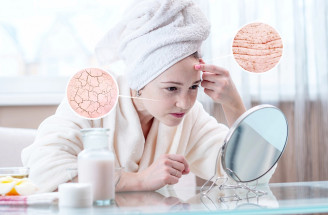 Najväčšie skincare chyby – POZOR, tieto praktiky môžu zhoršiť našu pleť!