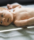 Neonatálny herpes: Príznaky, prenos a liečba novorodeneckého herpetického vírusu