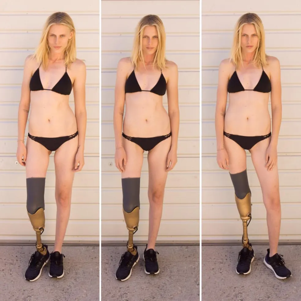 Lauren Wasser modeling 