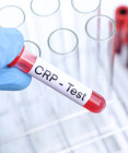 CRP test: Čo to je, ako sa robí a čo ukazujú výsledky a hodnoty?