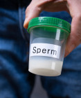 Spermiogram: Prvý krok k odhaleniu mužskej plodnosti. Príprava, priebeh, výsledky