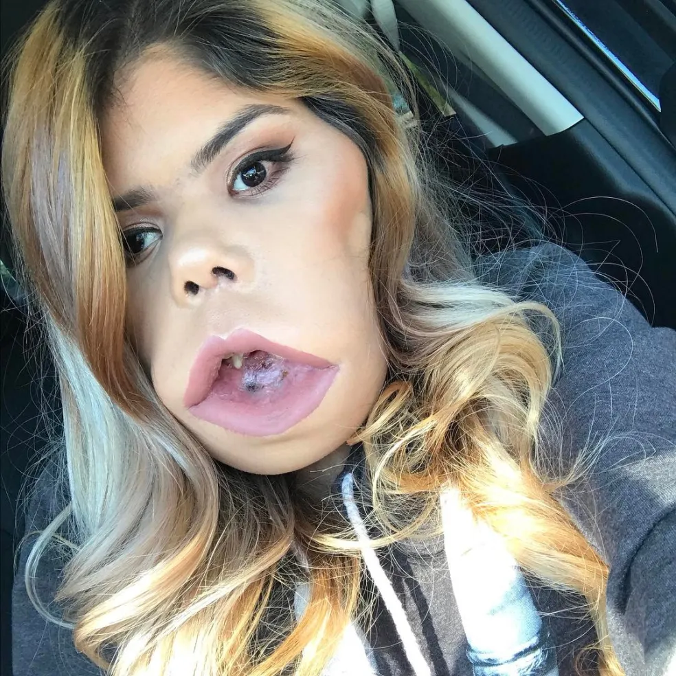 Marimar Quiroa