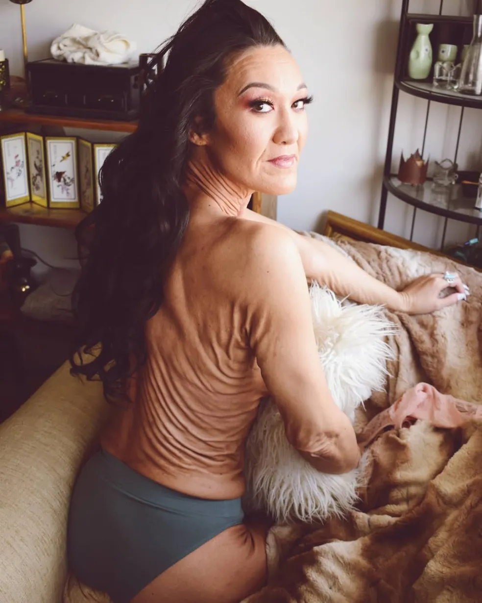 mdfoelka Sara Geurtsová