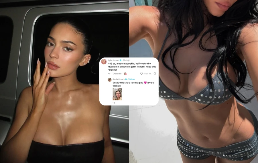 Kylie Jenner plastické operácie