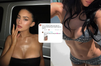 Kylie Jenner na žiadosť fanúšičky odhalila všetko o svojich implantátoch: Postupy aj meno chirurga!