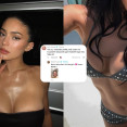 Kylie Jenner na žiadosť fanúšičky odhalila všetko o svojich implantátoch: Postupy aj meno chirurga!