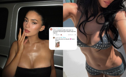 Kylie Jenner na žiadosť fanúšičky odhalila všetko o svojich implantátoch: Postupy aj meno chirurga!