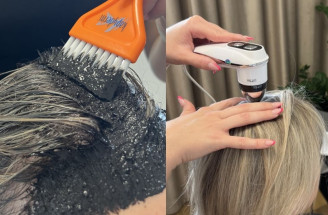 Trichologický inštitút Kapyderm – o ktoré problémy s vlasmi a pokožkou hlavy sa postará?