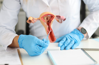 Dysplázia krčka maternice – je predzvesťou rakoviny? Ktoré ženy môže potrápiť?