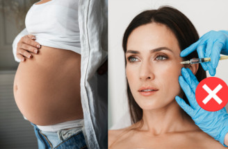 Beauty procedúry nevhodné v tehotenstve: Na ktoré si dať pozor a prečo?