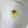 Ako odhalíš nedostatok tekutín v tele? Prezradí ti to farba moču!