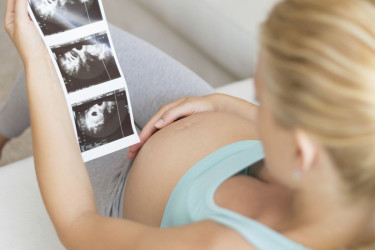 4 pravidlá ako pripraviť svoje telo na tehotenstvo?