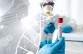 Genetické testovanie: Čo vám o zdraví prezradí a čo už nie?