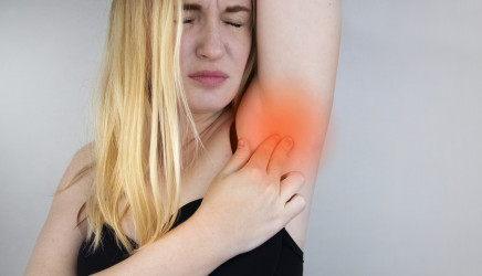 Hydrosadenitída – nepríjemný zápal v podpazuší. Ako sa prejavuje?