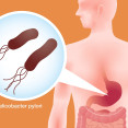 Helikobakter pylori: Spozoruj prvotné príznaky ochorenia čo najskôr!