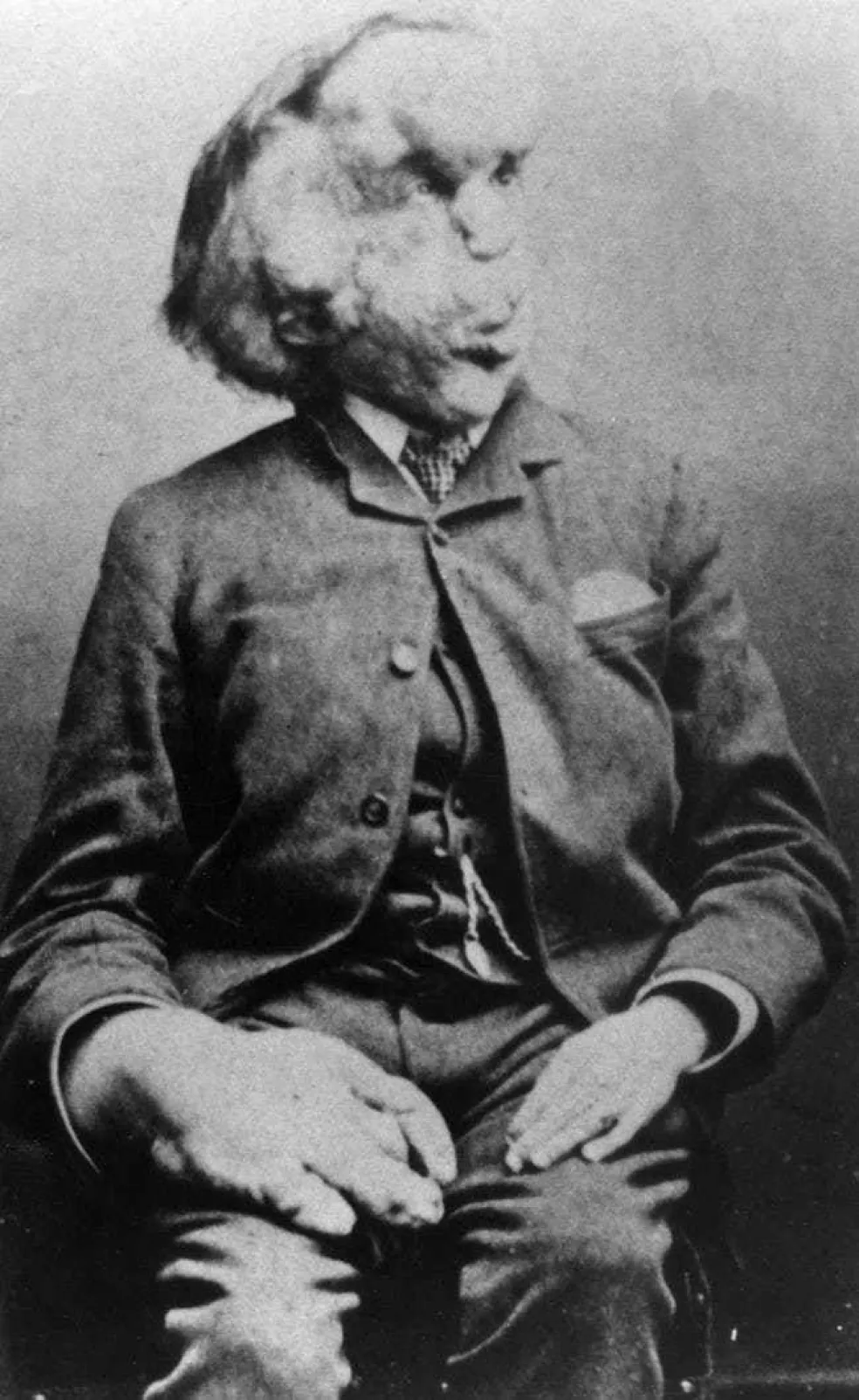 Joseph Merrick Sloní muž