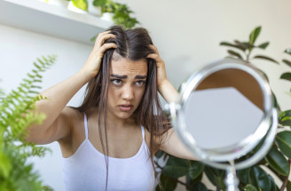 Domáce masky na mastné vlasy – 7 receptov, ktoré sa oplatí vyskúšať!