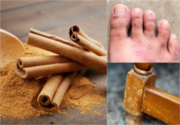 Ako využiť škoricu v domácnosti? 5 nevšedných spôsobov ťa dostane!