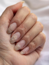 Biele, žlté, modravé: Varovné signály nechtov, ktoré netreba ignorovať