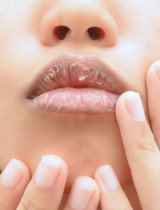 Nestačí ti ani len balzam na suché pery? Vyskúšaj naše tipy!