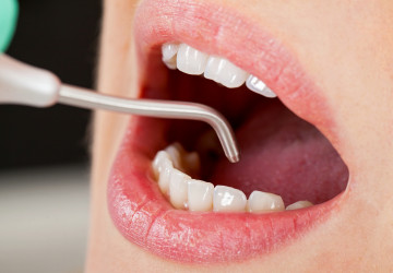 Pieskovanie zubov: Získaj aj ty biele zuby bez námahy! Ako na to?