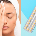 Ako hormonálna antikoncepcia ovplyvňuje pleť? Prináša pozitíva i negatíva!