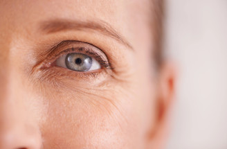 Prečo sa prvé vrásky objavujú práve okolo očí? Tieto tipy vám pomôžu!