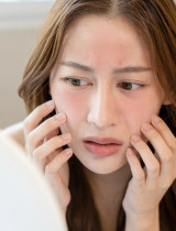 Rozdiel medzi suchou a dehydrovanou pleťou – 5 testov, podľa ktorých to spoznáte