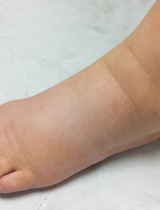 Zadržiavanie vody v tele: Máme užitočné rady, ako sa ho zbaviť