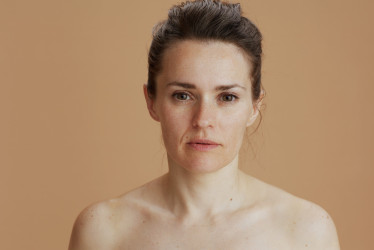 Dokonalosť? Už nie! Trend untouched face oslavuje prirodzenosť a stáva sa novým ideálom krásy