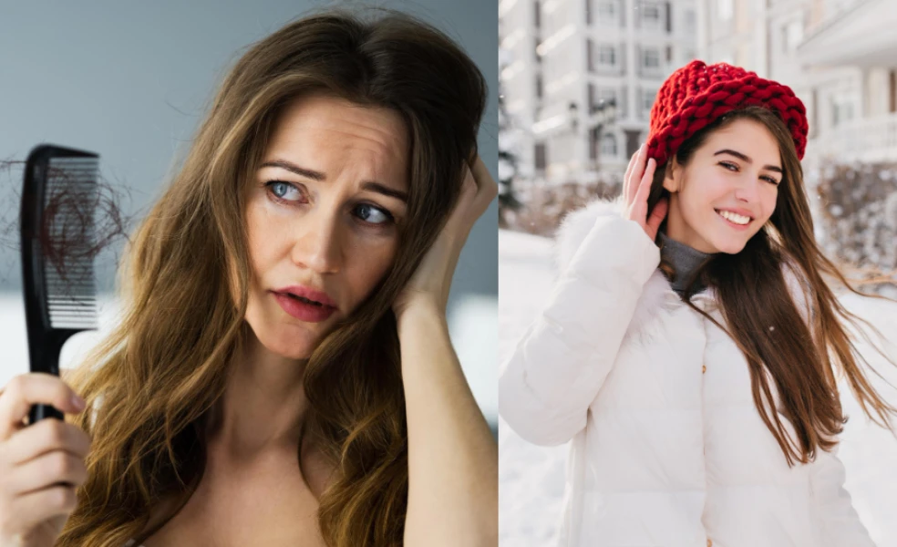 vypadávanie vlasov v zime