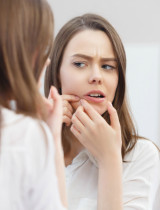 Vieš, ako odstrániť akné? Tieto domáce triky ti pomôžu!