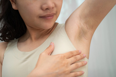 Tmavšia pokožka v podpazuší – aké sú možné príčiny a čo robiť, ak sa jej chceme zbaviť?