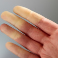Raynaudov syndróm: Ako sa prejavuje fenomén studených nôh a rúk?