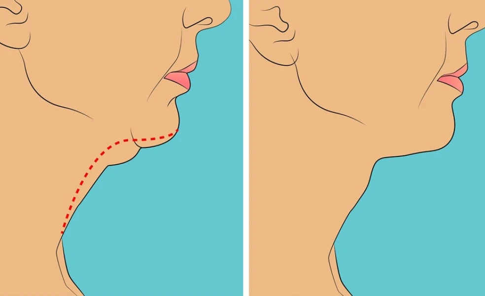 triky proti dvojitej brade