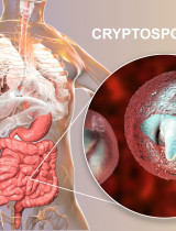 Nepríjemná parazitárna choroba: Aké ťažkosti spôsobuje kryptosporidióza?