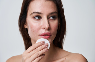 Najväčšie chyby v starostlivosti o pleť s akné a vyrážkami – tieto môžu zhoršiť stav pleti