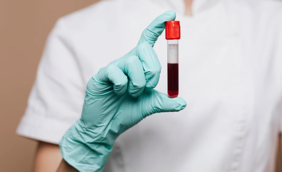 odber krvi príprava