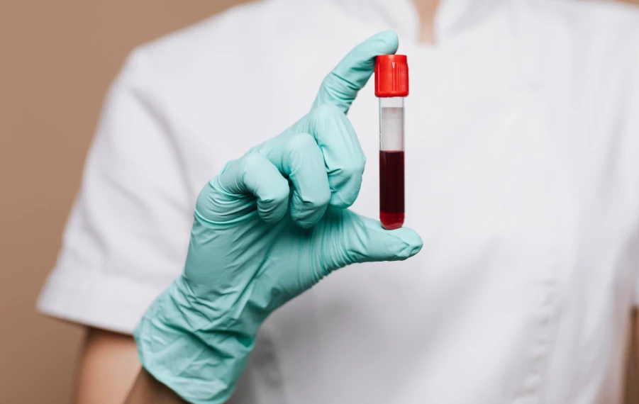 odber krvi príprava