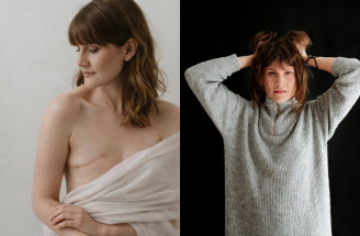 Erika Mokrý: Psychické následky po onkologických diagnózach sa často ignorujú, ale prežitie závisí aj od toho