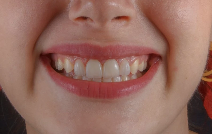 prečo nevynechávať dentálnu hygienu