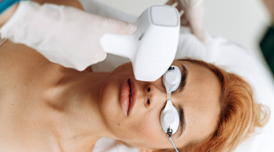 Laser alebo peeling? Ktoré estetické zákroky sa oplatí absolvovať ešte pred jarou