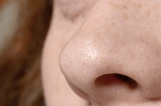 Prečo vznikajú upchaté póry v prechodnom období a ako ich vyčistiť